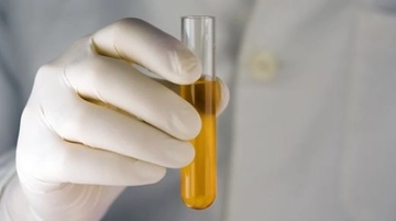 İdrarda Bol Bakteri Belirtileri ve Tedavisi İdrarda Bol Bakteri Belirtileri ve Tedavisi