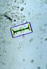 İdrarda Bakteri Belirtileri ve Tedavisi İdrarda Bakteri Belirtileri ve Tedavisi